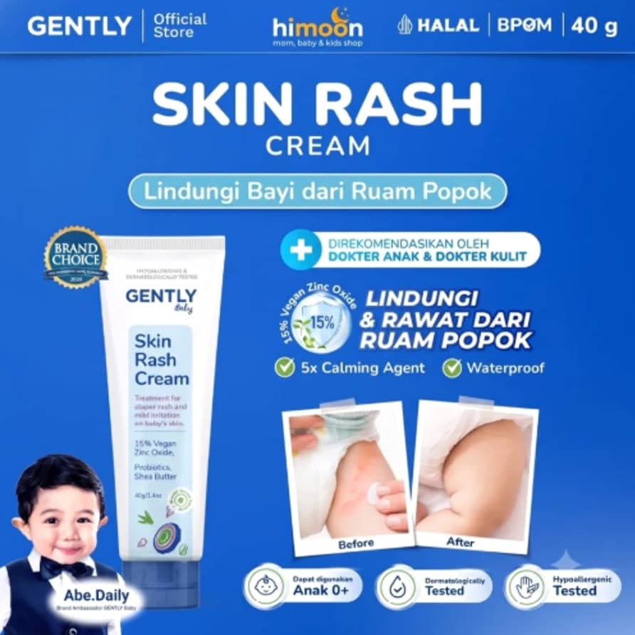 Gently Baby Rash Cream 40gr – Krim Pereda Ruam Popok Bayi Dermatologically Tested